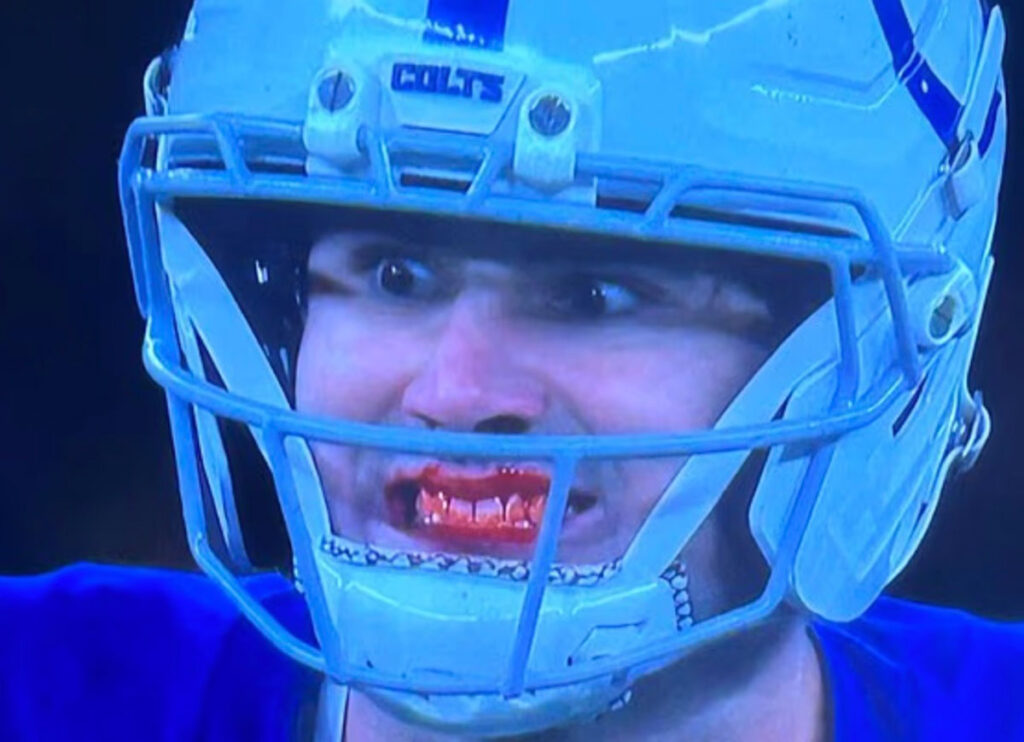 Colts QB Daniel Jones Bloody Mouth During Colts-Falcon Game Becomes Meme About Determination