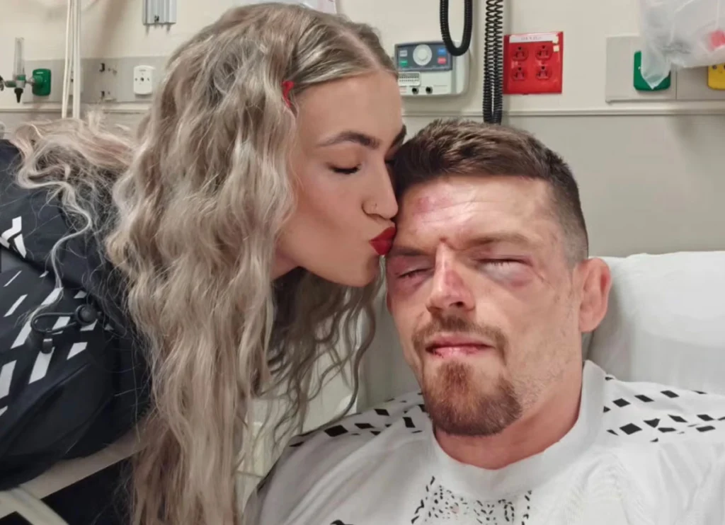 Harry Hardwick Suffers Broken Jaw During UFC Vegas 114 Main Card Event